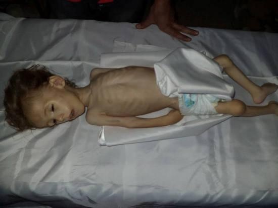 A child in Moadamiya who didn’t survive the regime's starvation campaign