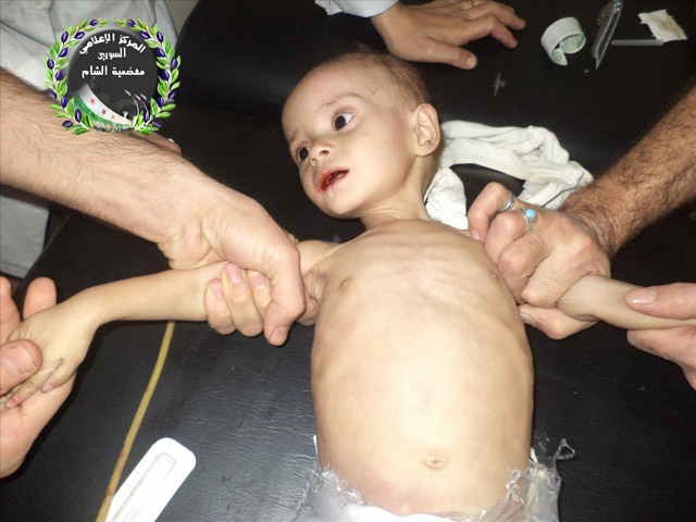 One-year-old Rana, who starved to death
